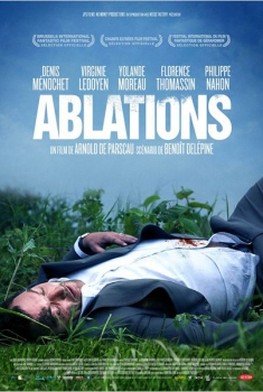 Ablations (2013)